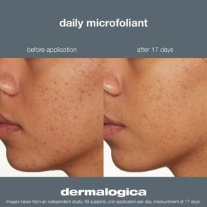 Dermalogica Daily Microfoliant® 75g